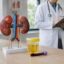 Doença renal crônica: sinais, diagnóstico e tratamentos disponíveis